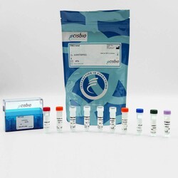 Revvity Health Sciences Inc HTRF Human & Mouse Total TBK1 Detection Kit,