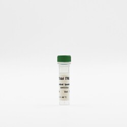 Revvity Health Sciences Inc HTRF Human Total STING Detection Kit, Control