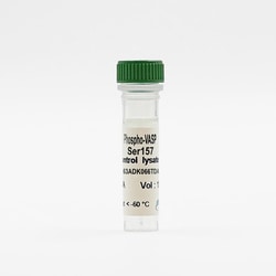 Revvity Health Sciences Inc&nbsp;HTRF Human & Mouse Phospho-VASP (Ser157) Detection Kit, Control Lysate