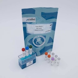 Revvity Health Sciences Inc HTRF Human Total IRAK3 Detection Kit, 500 Assay