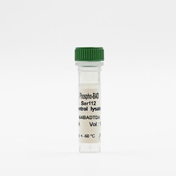 Revvity Health Sciences Inc HTRF Human Phospho-BAD (Ser112) Detection Kit,