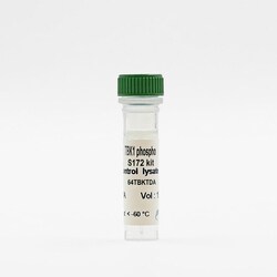 Revvity Health Sciences Inc HTRF Human & Mouse Phospho-TBK2 (Ser172) Detection Kit, Control Lysate