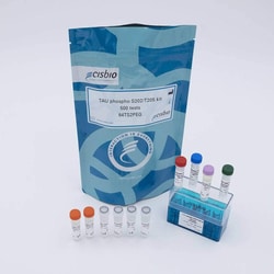 Revvity Health Sciences Inc HTRF Human Phospho-Tau (Ser202/Thr205) Detection