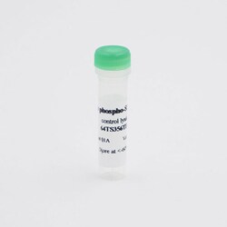 Revvity Health Sciences Inc HTRF Human & Mouse Phospho-Tau (Ser356) Detection Kit, Control Lysate