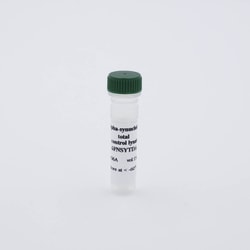Revvity Health Sciences Inc&nbsp;HTRF Human Total &alpha;-Synuclein Detection Kit, Control Lysate