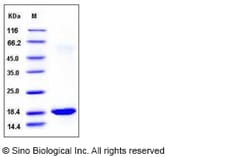 Sino Biological Recombinant Mouse IL-36RN/IL-1F5 Protein, Quantity: Each