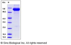 Sino Biological Mouse PSMA / FOLH1 Protein (His Tag) 100ug, Quantity: Each