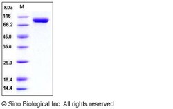 Sino Biological SARS-CoV-2 (2019-nCoV) 3CLpro / 3C-like protease-His &