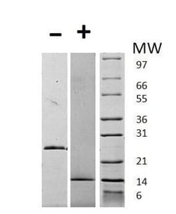 Abcam Recombinant Human GDF15 protein, 1MG, Quantity: Each of 1