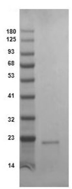 Abcam Recombinant human MMP13 protein (Active), Quantity: Each of 1