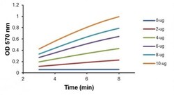 Abcam Recombinant human PCK1/PEPC protein (Active), 10UG, Quantity: Each