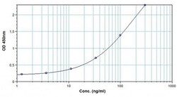 Abcam Denosumab ELISA Kit, 96TEST, Quantity: Each of 1