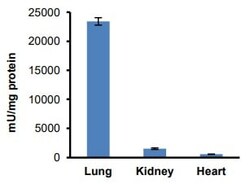 Abcam ACE Assay Kit (Angiotensin I Converting Enzyme), Quantity: Each of
