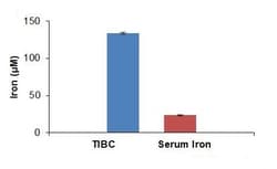 Abcam Total Iron-Binding Capacity (TIBC) and Serum Iron Assay Kit, Quantity: