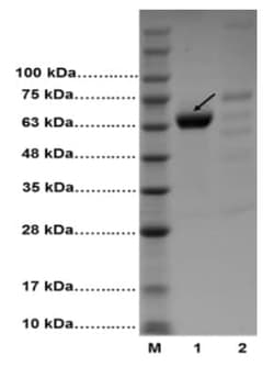 Abcam&nbsp;Albumin Depletion Kit