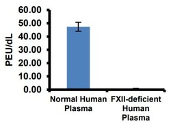 Abcam&nbsp;Factor XII / XIIa Assay Kit