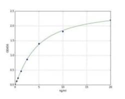 Abcam Human Estrogen Receptor beta ELISA Kit, 96TEST, Quantity: Each of