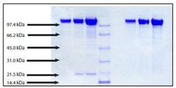 Abcam Native Human Ceruloplasmin protein, Quantity: Each of 1