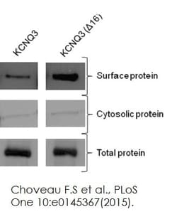 Abcam&nbsp;Plasma Membrane Protein E x traction Kit, 50 Tests