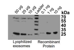 Abcam Overall Exosome Capture and Quantification ELISA Assay Kit, 96 Tests,