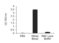 Abcam 1 x  Red Blood Cell Lysis Buffer, 100ML