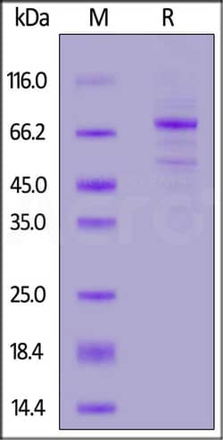 ACROBiosystems Human Cadherin-3, His Tag (CA3-H52H3) is expressed from