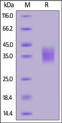 ACROBiosystems Biotinylated Human EMMPRIN, His,Avitag (CD7-M82E8) is expressed