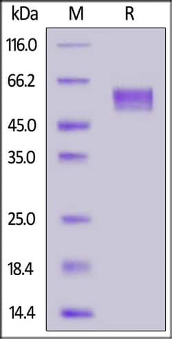 ACROBiosystems Biotinylated Human Siglec-8, His,Avitag (SI8-H82E9) is expressed