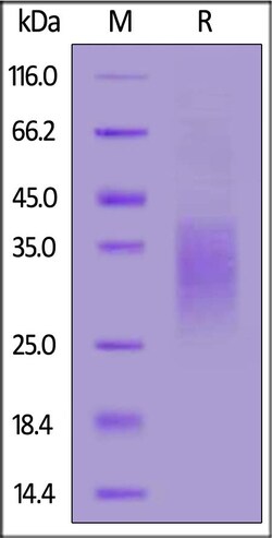 ACROBiosystems Human CD79A, His Tag (CDA-H52H8) is expressed from human