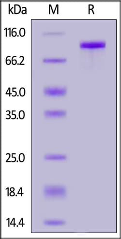 ACROBiosystems Biotinylated Human Sortilin / SORT1, His,Avitag (SON-H82E9)