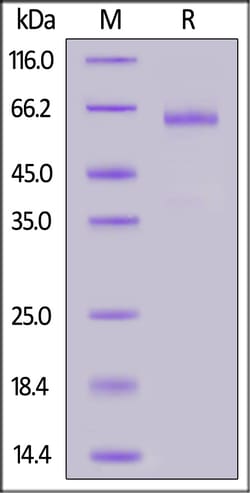 ACROBiosystems Human ADAM9, His Tag (AD9-H52H7) is expressed from human