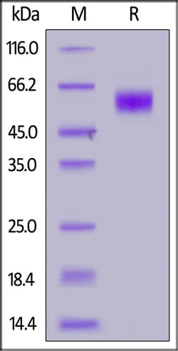 ACROBiosystems Mouse IL-1 RAcP, His Tag (ILP-M52H5) is expressed from human