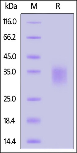 ACROBiosystems Human IL-9, His Tag (IL9-H52H9) is expressed from human