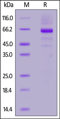 ACROBiosystems Human Glucosylceramidase, His Tag (GLE-H52H3) is expressed