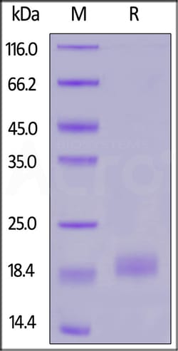 ACROBiosystems SARS-CoV-2 ORF8 Protein, His Tag (OR8-C52H1) is expressed