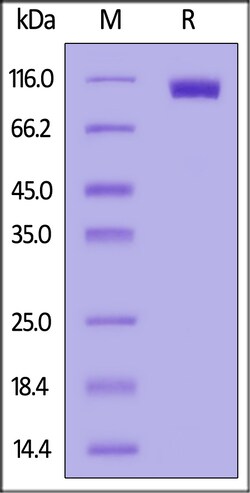 ACROBiosystems Epstein-Barr virus Envelope Glycoprotein B (gB), His Tag