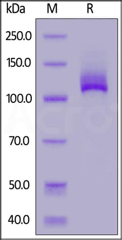 ACROBiosystems Biotinylated ENPP3, His,Avitag (EN3-H82E5) is expressed