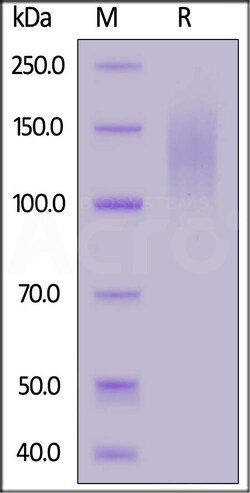 ACROBiosystems Cynomolgus CEACAM-5, His Tag (CE5-C52H5) is expressed from