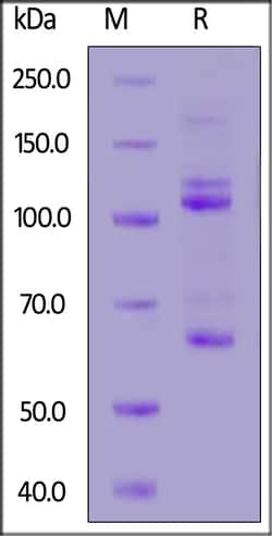 ACROBiosystems Mouse Complement component 3, His Tag (CO3-M52H4) is expressed