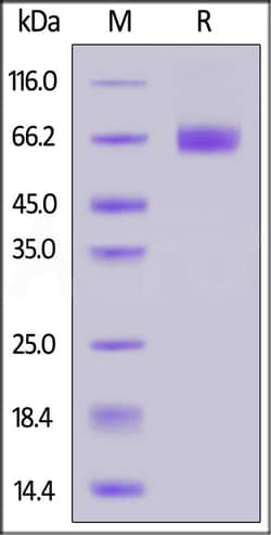 ACROBiosystems Inc FITC-Labeled Human CD19 (20-291), His Tag (CD9-HF2H3) is produced via conjugation of FITC to Human CD19 (20-291),  with a new generation site-specific technology under Star Staining labeling platform.   AA Pro 20 - Lys 291 ( # P15391-1).