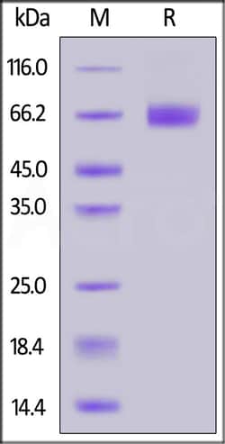 ACROBiosystems Inc FITC-Labeled Human CD19 (20-291), His Tag (CD9-HF2H3) is produced via conjugation of FITC to Human CD19 (20-291), with a new generation site-specific technology under Star Staining labeling platform.  AA Pro 20 - Lys 291 ( # P15391-1).