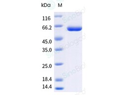 Sino Biological Influenza B (B/Austria/1359417/2021) Nucleoprotein / NP