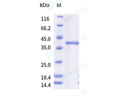 Sino Biological Recombinant Feline EGF Protein (ECD, hFc Tag), Quantity: