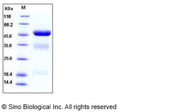 Sino Biological Recombinant Human BCA-1/CXCL13 Protein, Quantity: Each