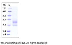 Sino Biological Recombinant Human RAGE Protein (His Tag), HPLC-verified,