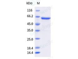 Sino Biological Human DCR3 / TNFRSF6B Protein (Fc Tag) 1mg, Quantity: Each
