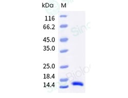 Sino Biological Monkeypox Virus (MPXV) Protein A35 (His Tag), Quantity: