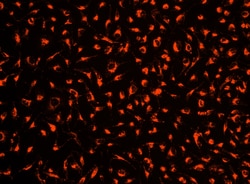 Aat Bioquest Cell Explorer Live Cell Tracking Kit Red Fluorescence (200