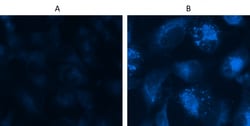 Aat Bioquest Cell Meter Autophagy Assay Kit Blue Fluorescence (200 Tests),
