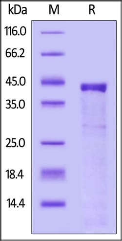 ACROBiosystems Human Cathepsin S, His Tag (CTS-H52H9) is expressed from